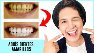 DIENTES SUPER BLANCOS EN 2 MINUTOS  BLANQUEA TUS DIENTES RAPIDO Y FÁCIL  AndyZaturno [upl. by Aicineohp971]