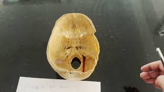 Jugular Foramen [upl. by Milks]