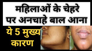 महिलाओं के चेहरे पर बाल क्यों आते हैं । कारण । Hirsutism क्या है  Causes  Prevention In Hindi [upl. by Norraa708]