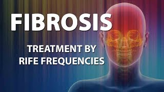 Fibrosis  RIFE Frequencies Treatment  Energy amp Quantum Medicine with Bioresonance [upl. by Brittani]