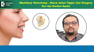 Protruding front teeth correction  Jaw Surgery for Perfect Smile DrVybhav Deraje Doctors Circle [upl. by Nnhoj]