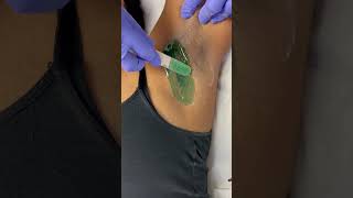 Professional underarm video waxing waxingexpert [upl. by Salokcin21]