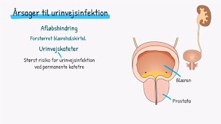 Nyrer og urinveje Urinvejsinfektion [upl. by Leroy772]