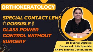 Contact Lens से रोक सकते हैं चश्में का नंबर  Orthokeratology [upl. by Gonnella]