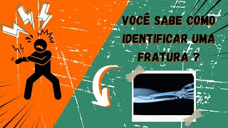 🤔🦴 quotVocê Sabe identificar Uma Fratura 👀🩺quot [upl. by Loux]