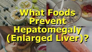 What Foods Prevent Hepatomegaly Enlarged Liver [upl. by Debbra213]