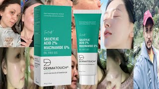 Dermatouch Salicylic Acid Niacinamide Oil Free Gel  Honest Review [upl. by Worden]