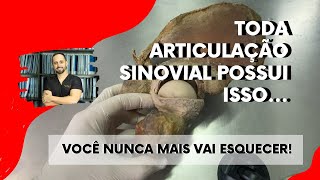 Anatomia da articulação sinovial [upl. by Emmy780]