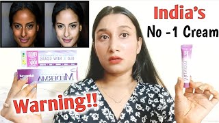 MEDERMA advanced Scar gel Review in hindiदाग धब्बे जड़ से मिटाएंSkin whitening creamhonest review [upl. by Quartas113]