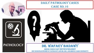 DAILY PATHOLOGY CASES CASE NO 16 BY DR WAFAEY BADAWY [upl. by Inahc242]