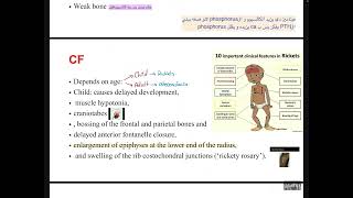 MBD4osteoporosis and osteomalacia [upl. by Ainoloppa]