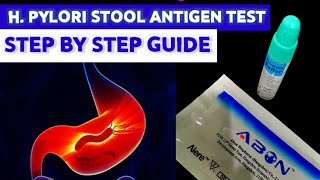 Helicobacter pylori Stool Antigen Test MEDICAL LABORATORY SCIENCE [upl. by Eiramave988]