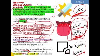 شرح ال Squamous cell carcinoma  TNM System [upl. by Dodson]