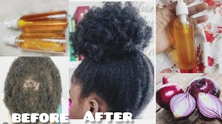 MAKE ONION HAIR OIL FOR FASTER HAIR GROWTH AND STOP HAIR FALL [upl. by Atiuqer]