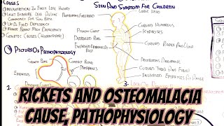 Rickets And Osteomalacia umerfarooqbiology7083 [upl. by Ahsieat]