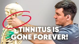 3 main causes of tinnitus Did this and everything passed [upl. by Ikila]