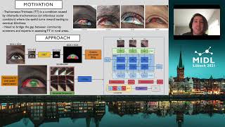 TT algorithm presentation [upl. by Salesin]