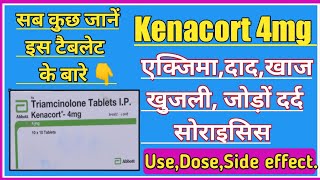 Triamcinolone। Kenacort 4mg Tablet Review।Use। Dose। Side effect। Precaution। हिंदी में। medicine [upl. by Beckett895]