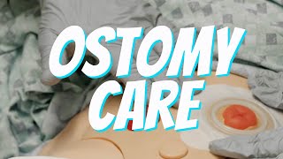 Colostomy and Ileostomy Care and Bag Change  Nurse Skill Demo [upl. by Rosemonde407]