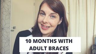 10 Month Adult Braces Progress [upl. by Vivle]