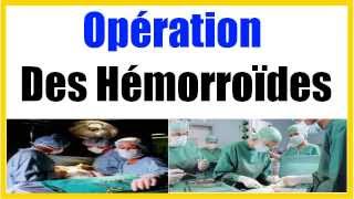 Operation Hemoroide [upl. by Auhsot]