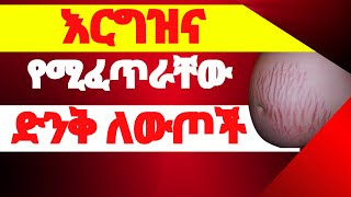 ብዙዎች የማትጠብቋቸው የእርግዝና ጊዜ ለውጦችChanges during pregnancy pregnancy signs pregnancytests [upl. by Annawt]