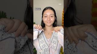 Say goodbye to Pigmentation in just 3 Steps skincare beauty shorts ytshorts [upl. by Enelegna626]