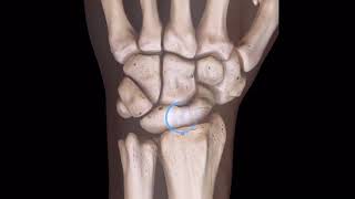 Scapholunate Ligament  and Clinical Significance [upl. by Otreblif782]