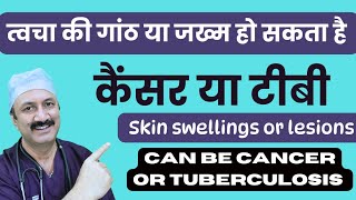 Skin swellings amp lesions त्वचा की गांठे और जख्म [upl. by Erickson]