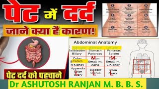 Abdomen pain cause पेट दर्द को कैसे पहचाने Acute abdominal painAbdomen pain symptom medical school [upl. by Artamas]