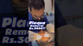 Plaque Removal in just Rs2999 aedatukamedian [upl. by Xer]