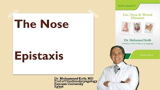 The nose Epistaxis causes amp management Professor Dr Mohamed Qotb [upl. by Nnyllatsyrc314]