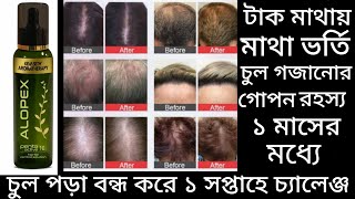 How to control hair fall in one week challenge  keya seth alopex penta active 10 honest review [upl. by Arul]