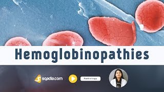 Hemoglobinopathies  Pathology Video Lectures  Medical Student Education  VLearning [upl. by Adyam989]