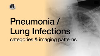 Pneumonia  Lung Infections [upl. by Garnette970]