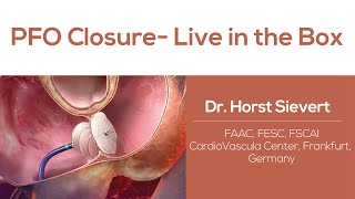 PFO Closure Live in the Box [upl. by Enyedy]