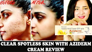 Aziderm cream  Aziderm cream review  aziderm cream 10  aziderm 10 gel  azelaic Acid  scarsmark [upl. by Brianne]