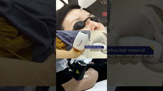 3 tips for using this diode laser hair removal machine [upl. by Derwin]