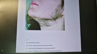 hirsutism pharmacology [upl. by Hannibal]