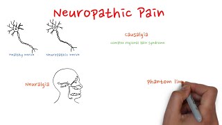 Neuropathic pain [upl. by Gates479]