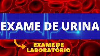 EXAME DE URINA  COMO FAZER PARA QUE SERVE COMO INTERPRETAR  TUDO SOBRE EXAME DE URINA [upl. by Baiel]