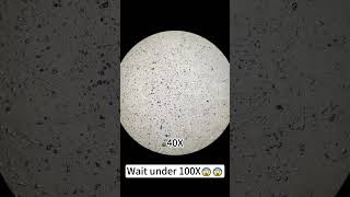 A pimple magnified 400X is seriously fascinatingunderthemicroscope microscope science [upl. by Iila]