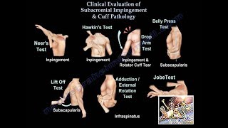 Clinical Examination Of Shoulder amp Rotator Cuff  Everything You Need To Know  Dr Nabil Ebraheim [upl. by Noir]