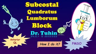 Subcostal QL Block I Anterior Quadratus Lumborum block  Subcostal Approach I Modified Subcostal QLB [upl. by Cerallua]