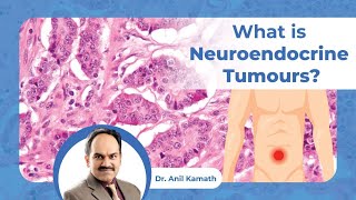 What is Neuroendocrine Tumours  Symptoms and Treatment  Dr Anil Kamath Surgical Oncologist [upl. by Ilac]