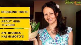 The Shocking Truth About Hashimotos  High Thyroid Antibodies [upl. by Evette]