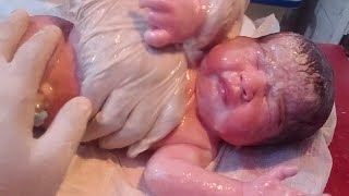 New born baby cleaning removed vernix baby oil is used baby need good cleaning looking so beautifull [upl. by Asselam]