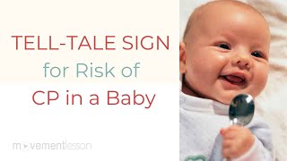 TELLTALE SIGN for Risk of Cerebral Palsy CP in a Baby [upl. by Hudnut]