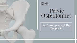 Pelvic Osteotomies for Developmental Hip Dysplasia  DDH [upl. by Nylad]