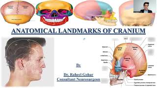 Craniometric Points Taylor Haughton Lines And Surgical Access Points on Skull [upl. by Aniretak]